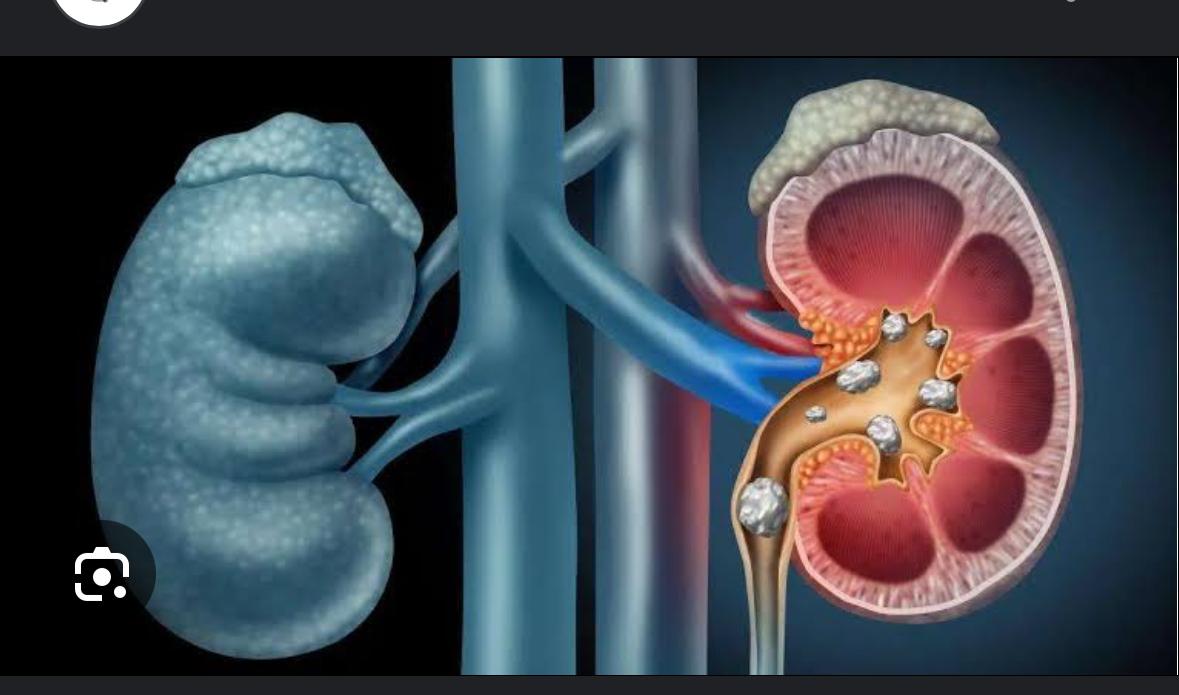 Urology